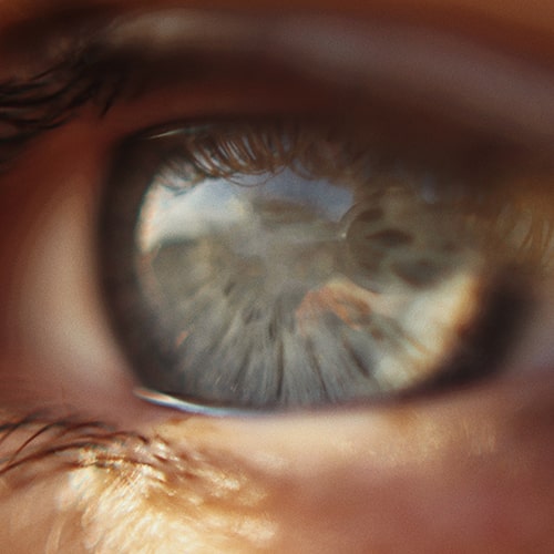 Macro image of a person's eye with no pupil - Elia Pellegrini on Unsplash